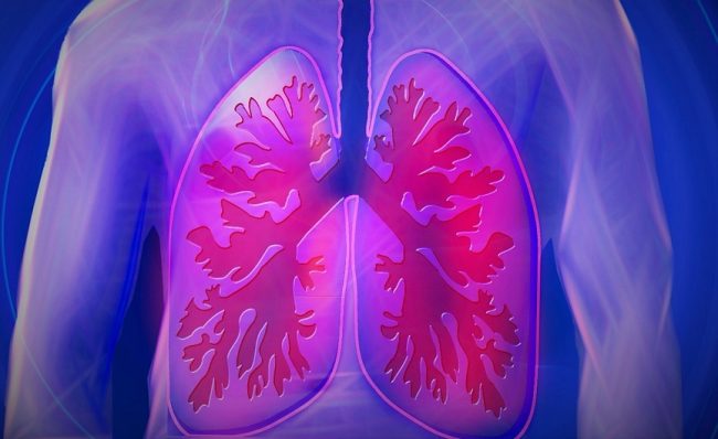 Vaping Injury Lawyer Texas